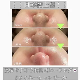 beautysalon RAVIS所属・東大阪/韓国肌管理/ 痩身バスト専門店のエステ・リラクイメージ