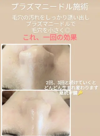 韓国肌＆毛穴洗浄 Beautsaineのエステ・リラクイメージ