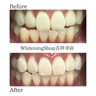 ホワイトニング ショップ吉祥寺店のエステ・リラクイメージ