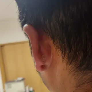 耳ツボセラピスト MISAのエステ・リラクイメージ