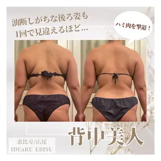 恵比寿インディバ痩身 スーパーバイザー柳澤のエステ・リラクイメージ