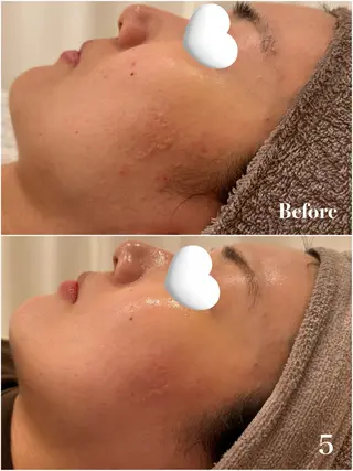 Ayaka🤍 恵比寿/美容鍼/整体のエステ・リラクイメージ