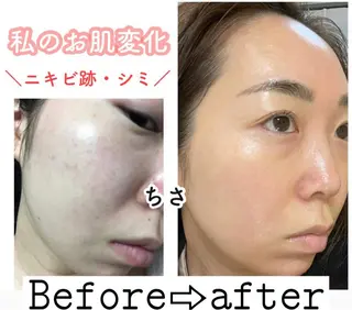 ショート カラー パーマ ヘアアレンジ メンズ キッズ ネイル マツエク・マツパ ニキビ&跡改善サロン オーナー光木のエステ・リラクイメージ