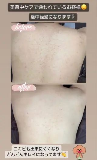 ベラージュ【美背中・ 美尻・フェイシャル】のエステ・リラクイメージ