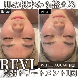 中目黒ハーブピーリン グ🌿ララピールのエステ・リラクイメージ