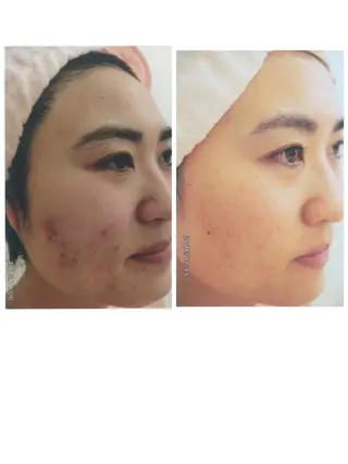 マドンナ 富士店のエステ・リラクイメージ