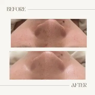 CEsalonEgg 齋藤のエステ・リラクイメージ