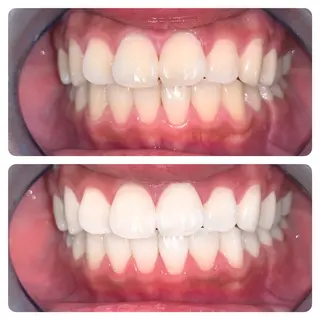 ネイル アイブロウ マツエク・マツパ メンズ パーマ ロング カラー ライトビューティー 銀座本店のエステ・リラクイメージ