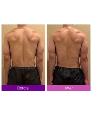 ☆痩身/小顔☆ 結果出します☆のエステ・リラクイメージ