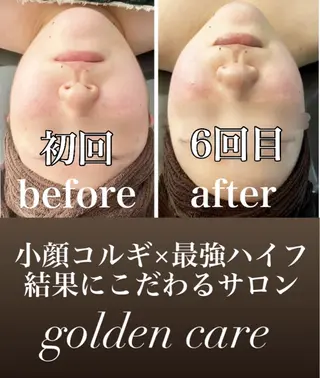■超絶小顔＆肌管理室■所属・🦋整形級の究極美顔 本格韓国式小顔🦋のエステ・リラクイメージ