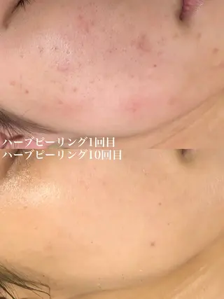 WHITE AQUA 北千住店のエステ・リラクイメージ