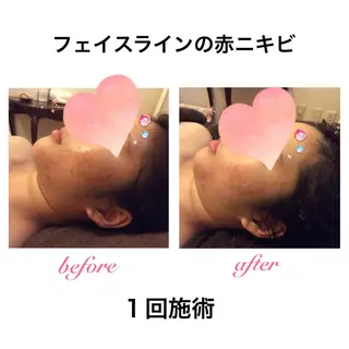 ダイエット・美肌ケア fleurのエステ・リラクイメージ