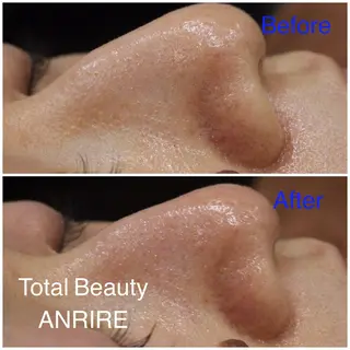 ANRIRE (アンリール)のエステ・リラクイメージ