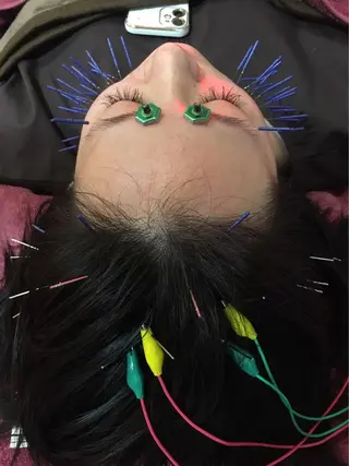 美容鍼灸女性専用 りんご鍼灸治療院のその他イメージ