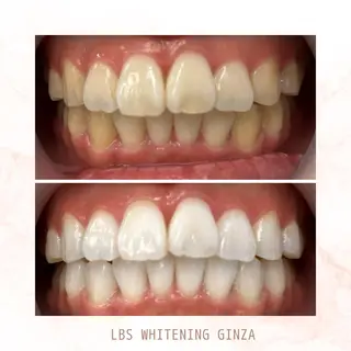 メンズ LBSホワイトニング 銀座店💎店長浦和のその他イメージ