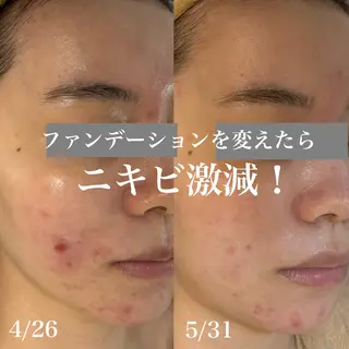 WHITE AQUA 北千住店のエステ・リラクイメージ