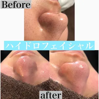 美肌脱毛と癒しのﾌﾟﾗｲﾍﾞｰﾄｻﾛﾝ。gratia~ｸﾞﾚｲﾃｨｱ~所属・gratia ~ｸﾞﾚｲﾃｨｱ~のエステ・リラクイメージ