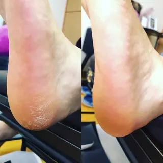 ネイル 伊藤 舞のネイルデザイン