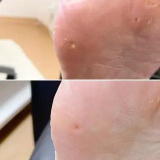 ネイル 深爪・巻き爪 専門サンセリテのネイルデザイン