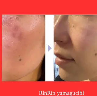 RinRin 山口店のエステ・リラクイメージ