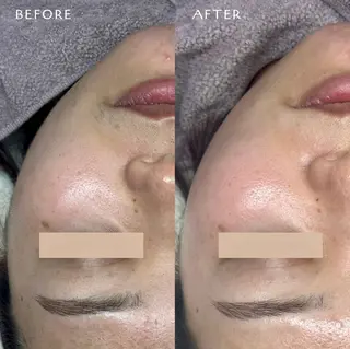 フェイシャルワックス KANAKOのエステ・リラクイメージ