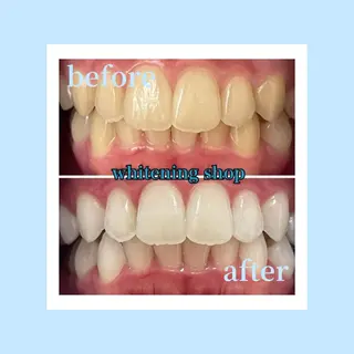 ホワイトニングショップ光明池店所属・ホワイトニング ショップ光明池店のエステ・リラクイメージ