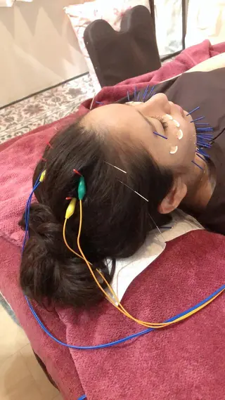 美容鍼灸女性専用 りんご鍼灸治療院のその他イメージ