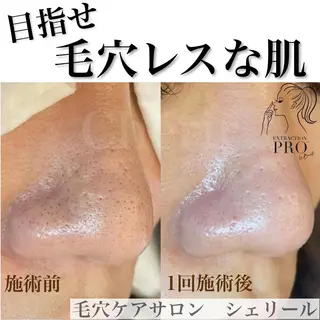 シェリール✳︎ Erinaのマツエク・マツパデザイン