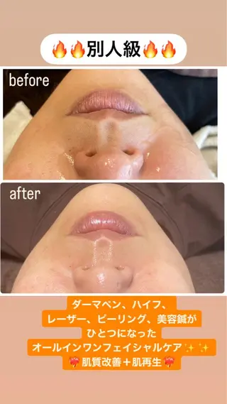 ロング カラー パーマ ヘアアレンジ メンズ ネイル マツエク・マツパ アイブロウ ビューティーサロンRavi所属・ビューティーサロン Raviのエステ・リラクイメージ