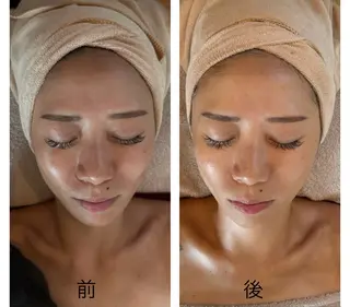 MiEL  total beaty salon所属・肌質改善サロン ナツコのエステ・リラクイメージ