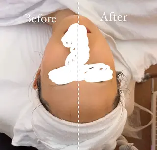 肌質改善サロン🌕 ⠀【ルーナピエナ】のエステ・リラクイメージ