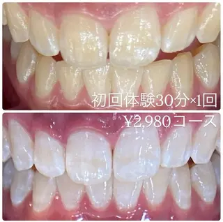 メンズ ホワイトニングルーム　川崎店所属・ホワイトニング ルーム　川崎店のその他イメージ