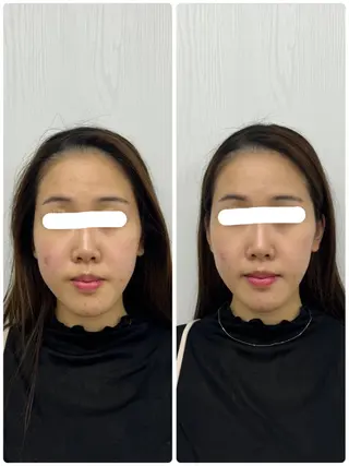 美容鍼×小顔矯正 ×美容整体 浜川泰仁のエステ・リラクイメージ