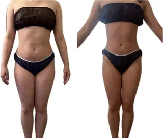 本気で痩せたい方へ 痩身専門サロンのその他イメージ