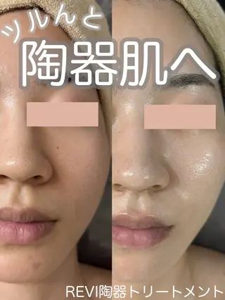 WHITE AQUA 北千住店のエステ・リラクイメージ