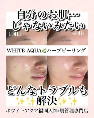 メンズ キッズ WHITEAQUA 福岡天神店のエステ・リラクイメージ