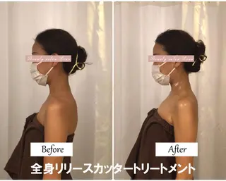 痩身×フェイシャル ブライダル|Linoのエステ・リラクイメージ