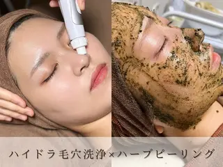 HINANO矢場町店【ヒナノ】所属・脱毛/肌改善🌿 HINANO 村田のエステ・リラクイメージ