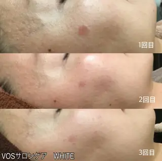 メンズ マツエク・マツパ エステ.まつげ.小顔 眉毛.プラズマ.脱毛のマツエク・マツパデザイン