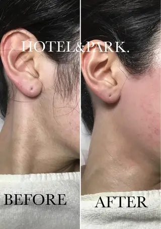 HOTEL&PARK . ワックス脱毛のエステ・リラクイメージ