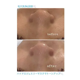 志免町 フェイスシャルエステのエステ・リラクイメージ