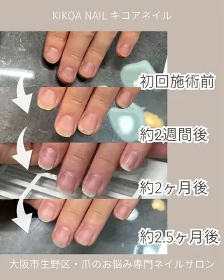 ネイル KIKOA NAIL キコアネイルのネイルデザイン