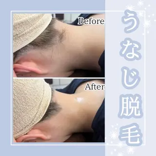 メンズ キッズ Amaryllis 🌹松本のエステ・リラクイメージ