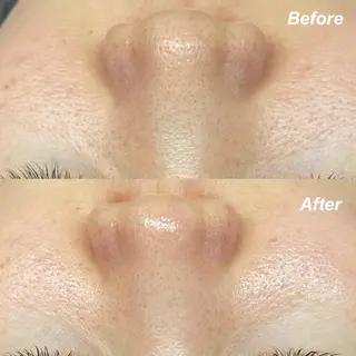 hitomi ヒトミのエステ・リラクイメージ