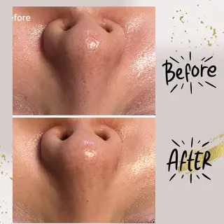 ピーリング専門店 Belluteのエステ・リラクイメージ