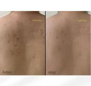 肌質改善サロン　toihealing所属・肌質改善サロン トワヒーリングのエステ・リラクイメージ