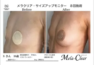 光美容シャムロック バスト、シミ専門店のエステ・リラクイメージ