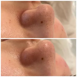 ✨美肌水光✨ アトリエリュバンのエステ・リラクイメージ