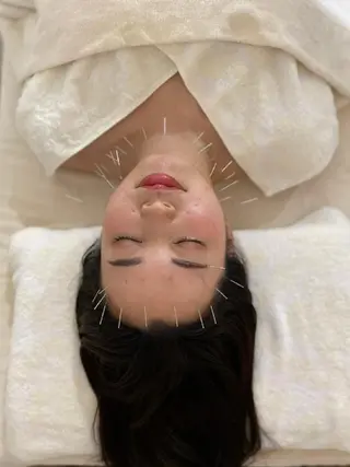 Brilo（ブリーロ）美容鍼灸サロン所属・💙美容鍼💙美顔矯 正🧡Brilo🧡のエステ・リラクイメージ