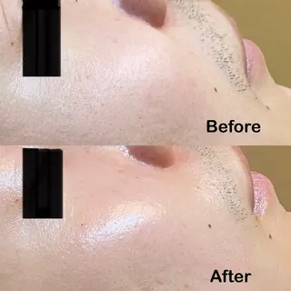 メンズ Ranan【ラナン】 keikoのエステ・リラクイメージ